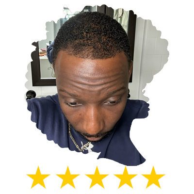 The Hair Growth Oil made my hairline fuller and thicker after using it for about a month.
